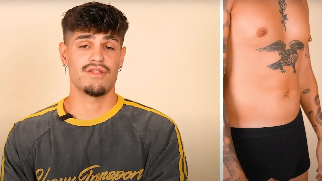  Álvaro Rubio s'opera per segona vegada d'una liposucció