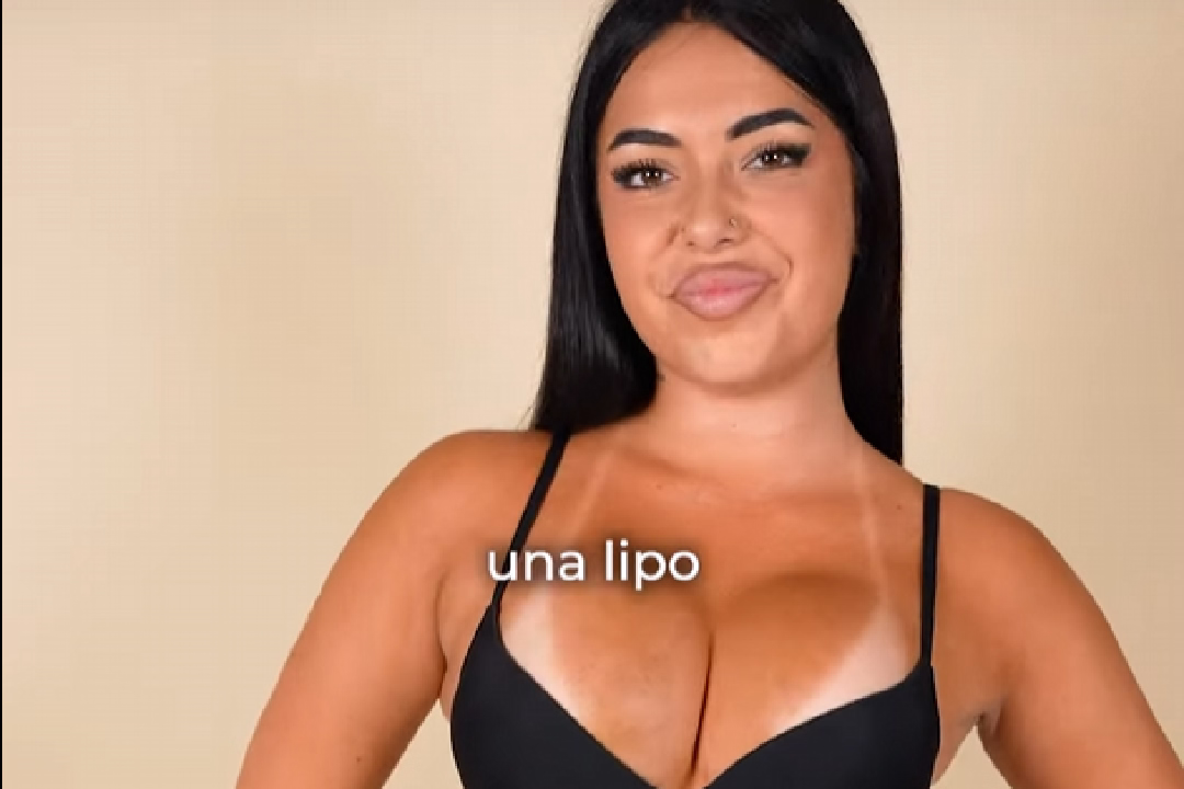 La Carla es fa un augment de glutis