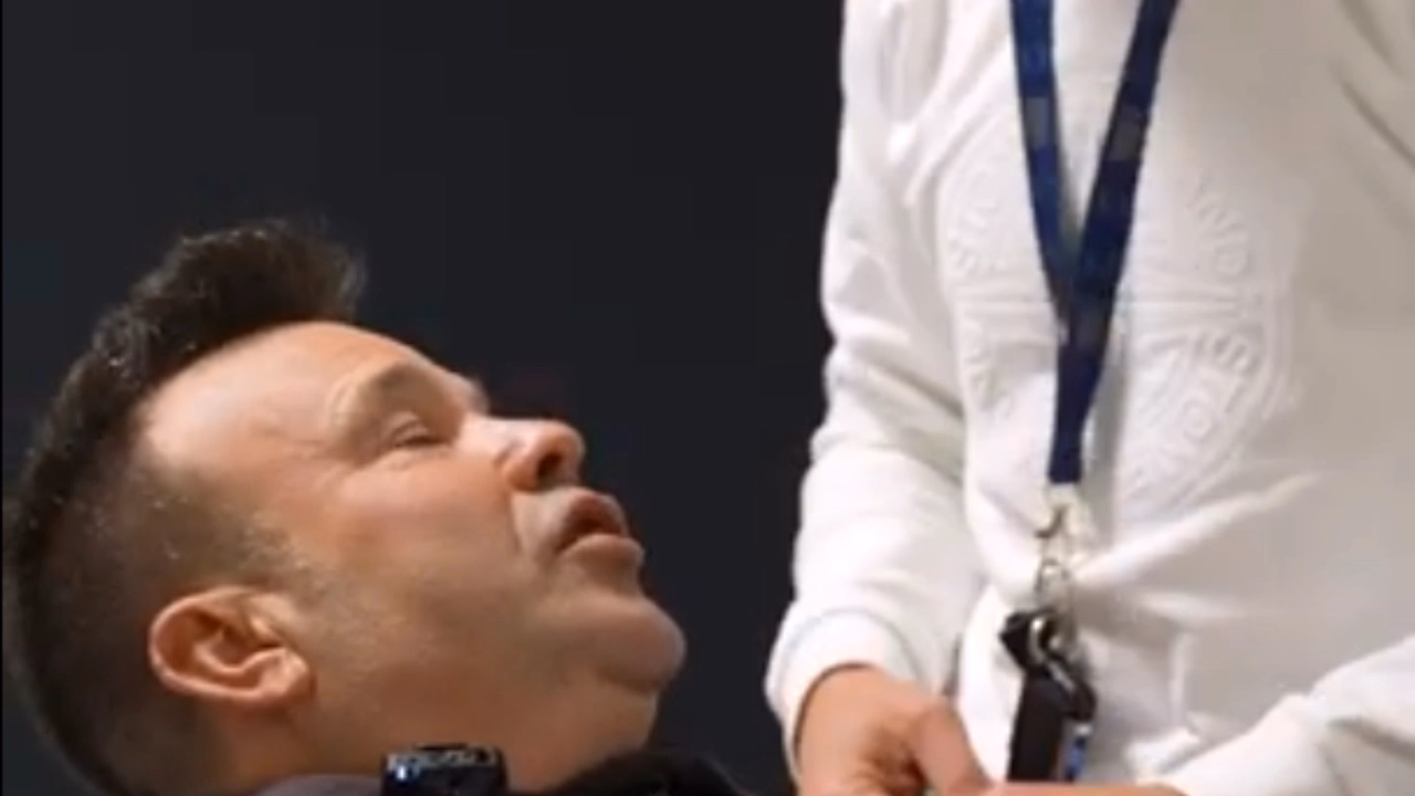 José Elías i el seu impactant rejoveniment facial a EGOS