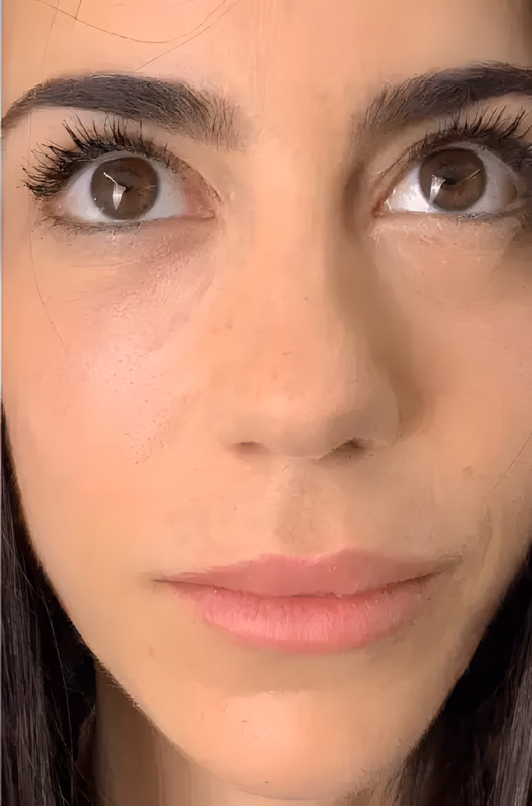 Después — Micropigmentación Ojeras