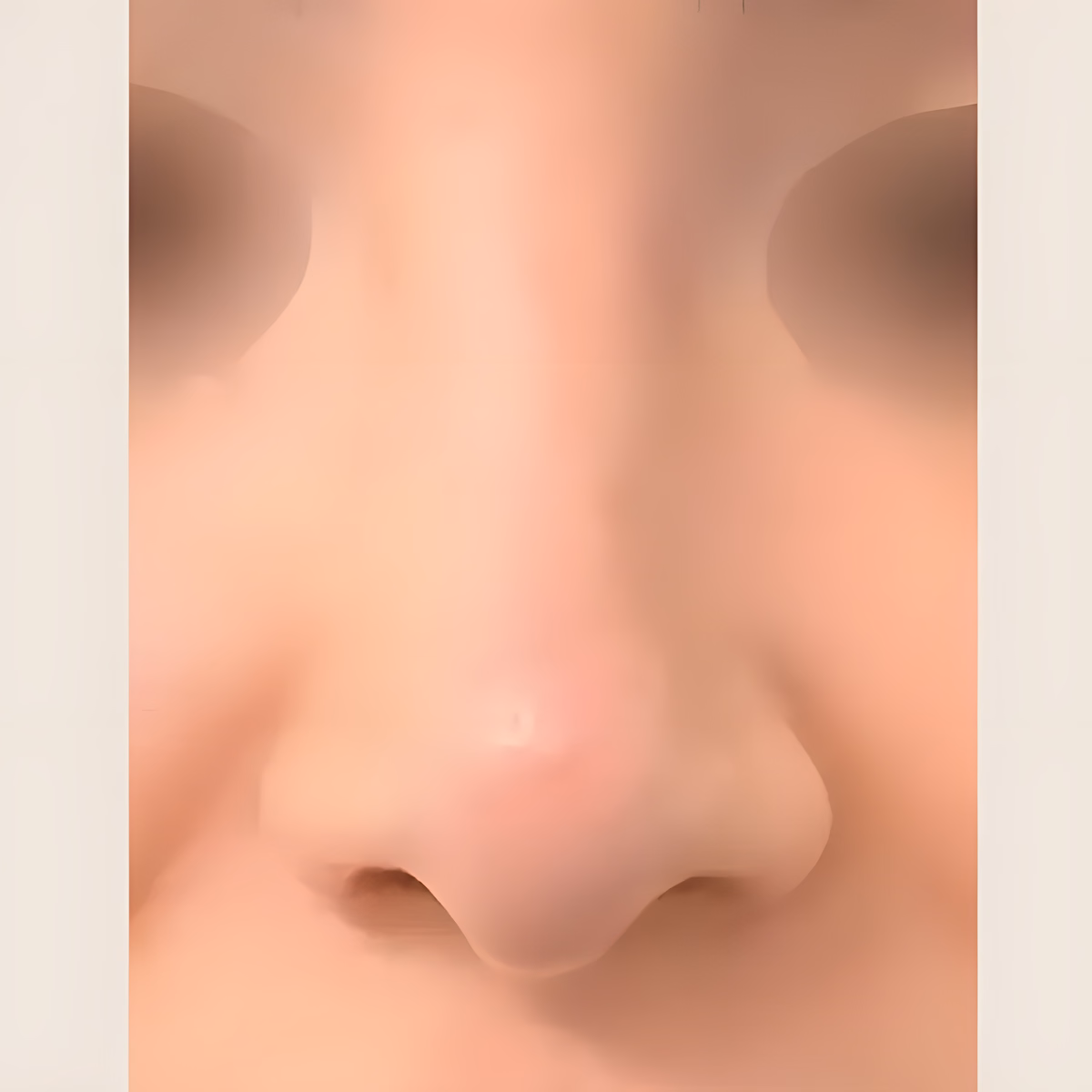 Después