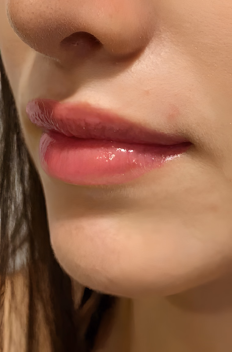 Después — Micropigmentación de Labios