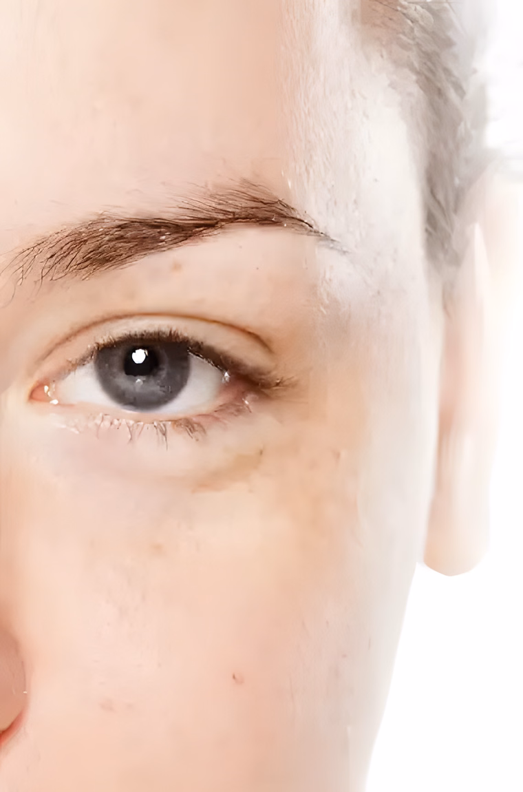 Antes — microblading técnica pelo a pelo