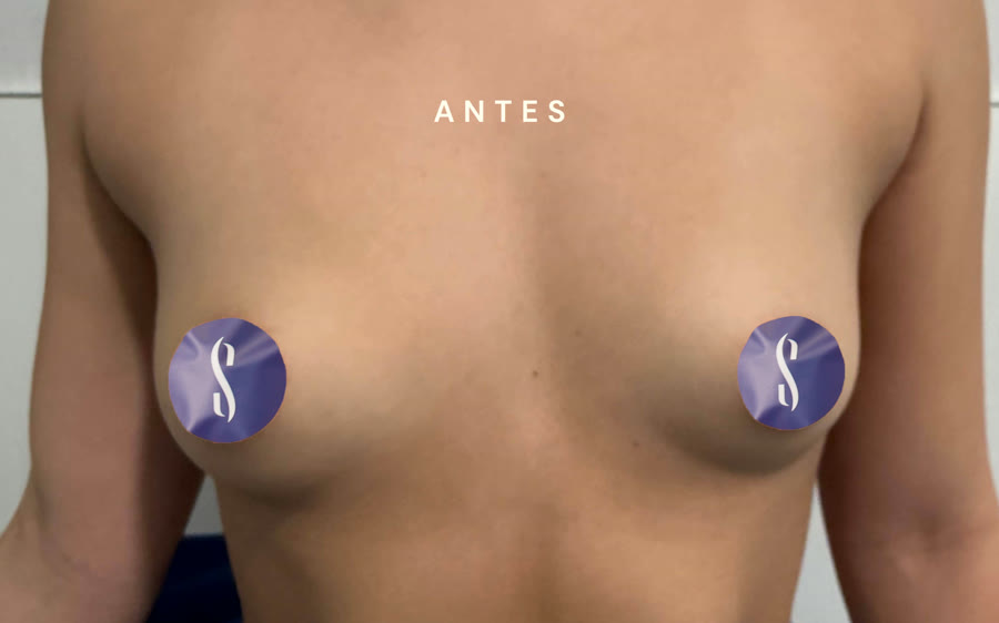 Abans