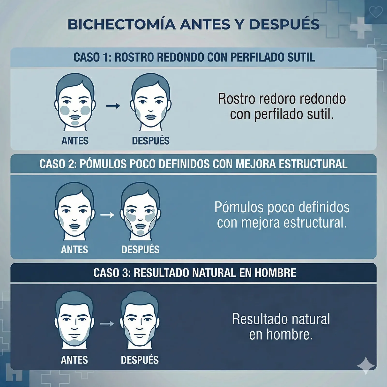 Bichectomía antes y después