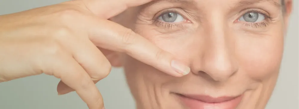 Tudo sobre a Blefaroplastia Inferior: cicatriz, preço e recuperação