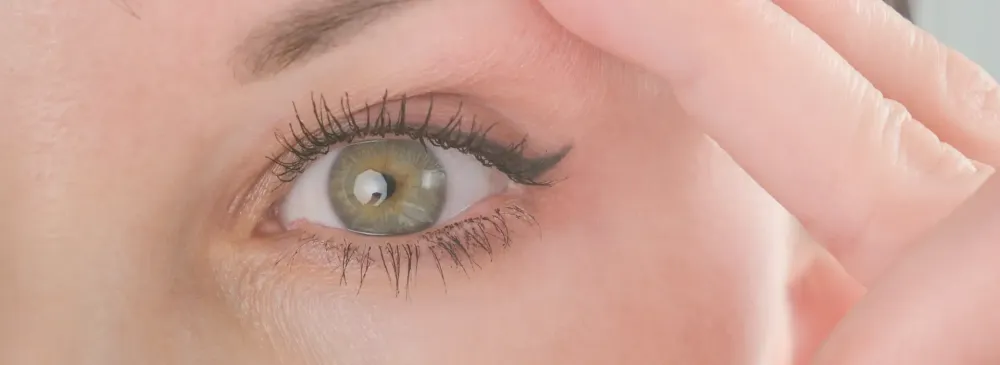 O que é a blefaroplastia superior? Tudo o que precisa de saber.