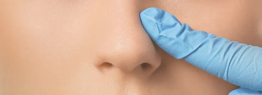 Diferença entre rinoplastia ultrassónica e rinoplastia tradicional