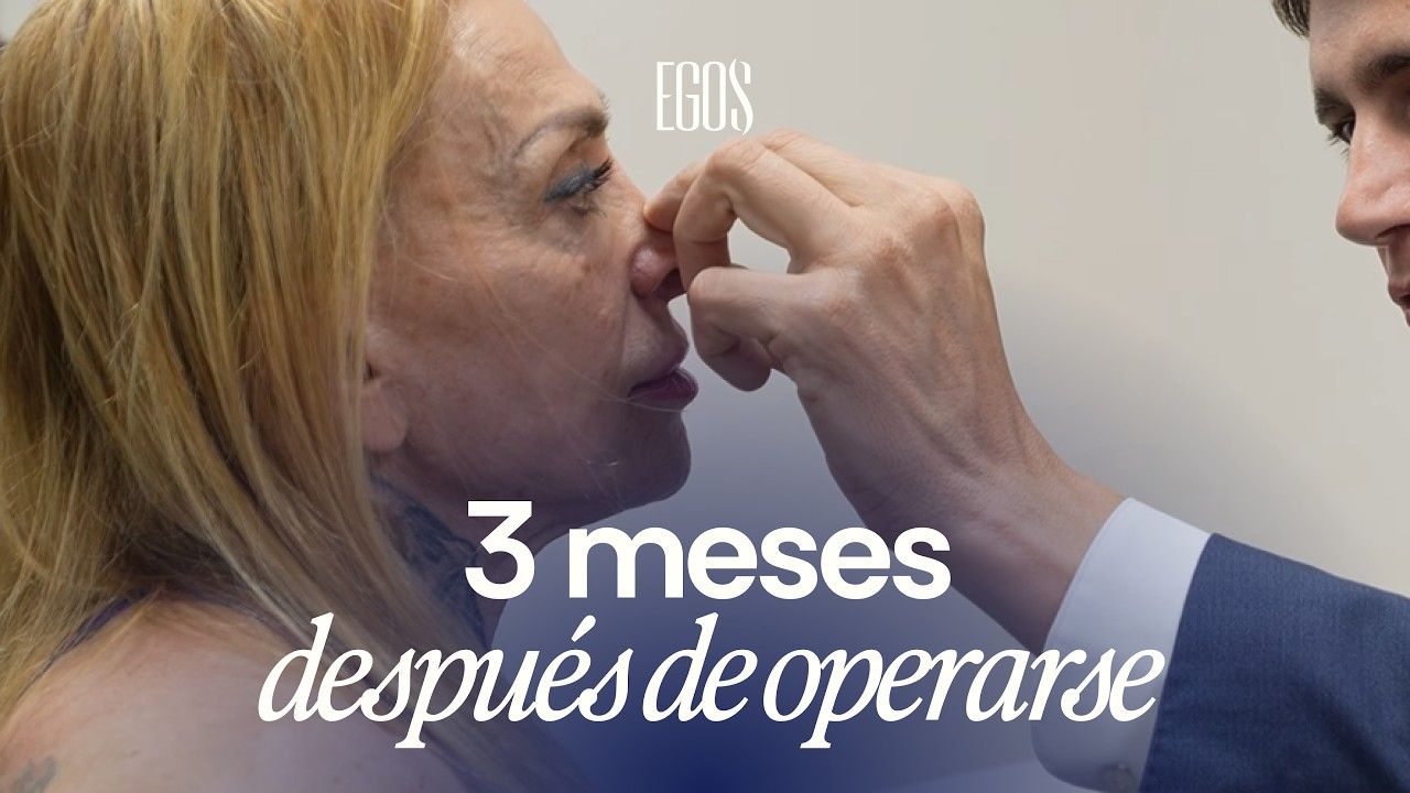 La rinoplastia de Paloma Parra: su experiencia y recuperación tres meses después